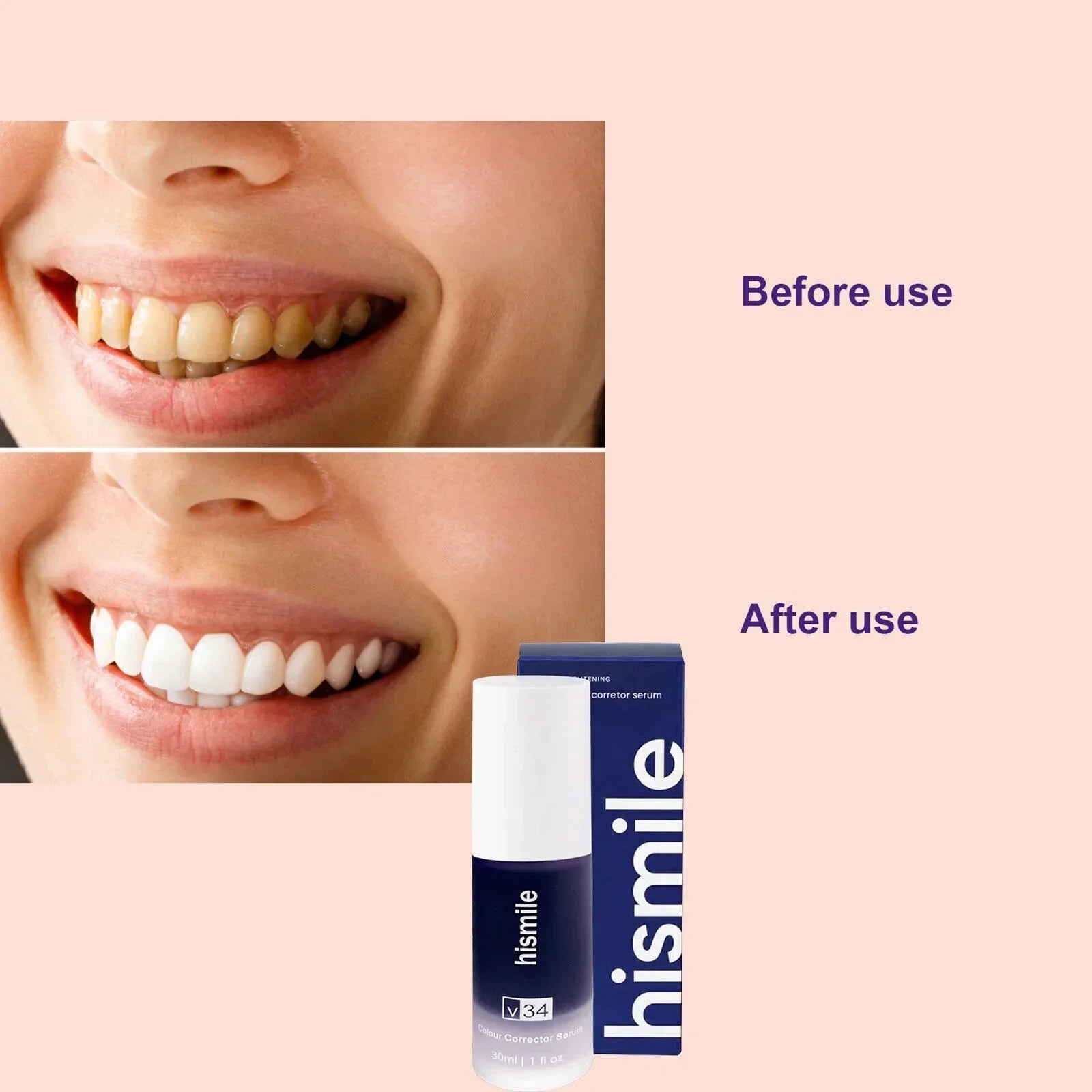 Hismile v34 Color Corrector Serum - Instant Teeth Whitening