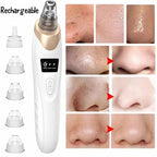 5-in-1 Rechargeable Pore Cleaner – Gentle Suction Facial Care Tool