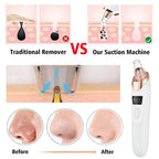 5-in-1 Rechargeable Pore Cleaner – Gentle Suction Facial Care Tool